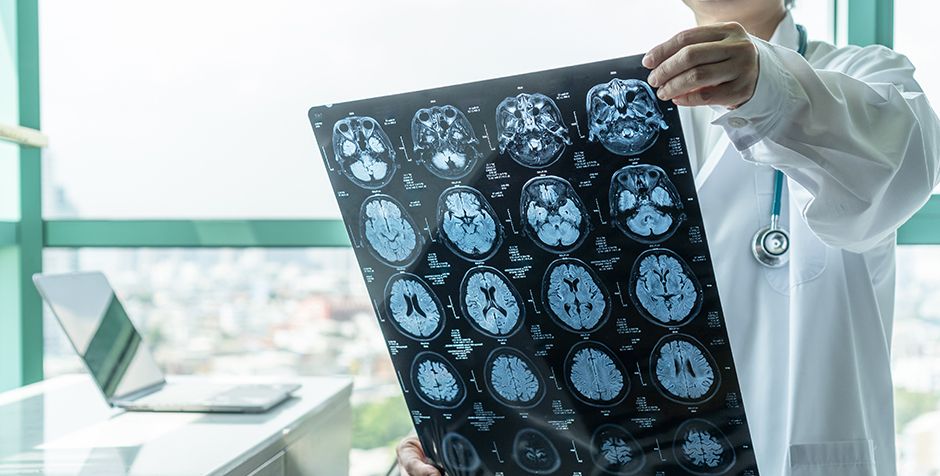 image Brain Injury