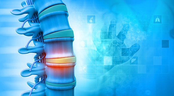 spinal-cord Spinal Cord Injury